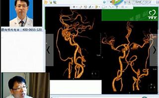 三博醫(yī)院劉方軍：顱內(nèi)外血管搭橋治療復(fù)雜頸內(nèi)動脈動脈瘤