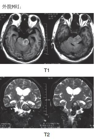 外院MRI