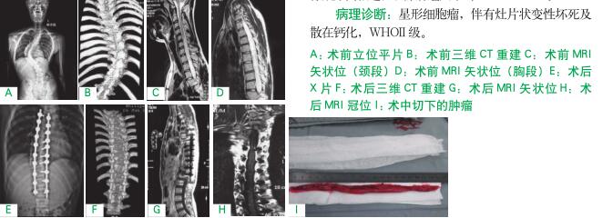 術(shù)前立位平片