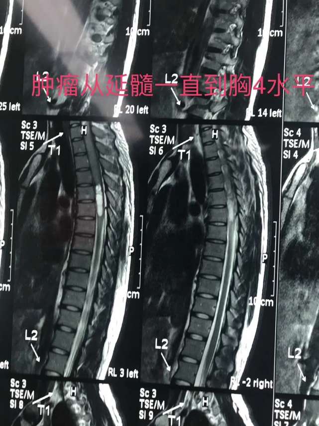 患者影像資料