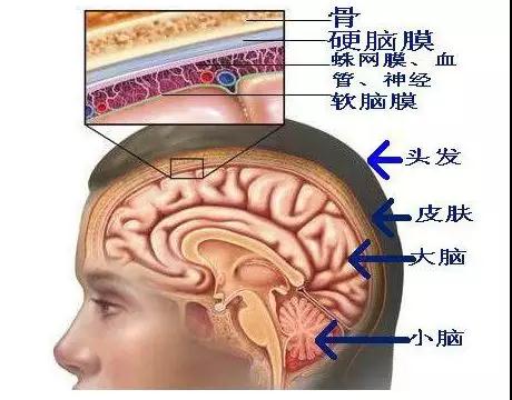 腦膜瘤主要長在蛛網(wǎng)膜上