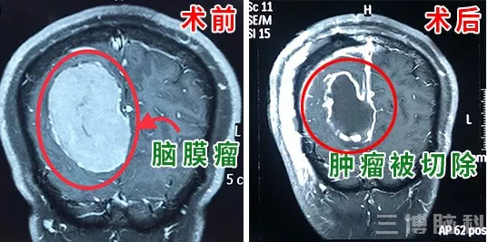 QQ截圖20181120165643.png