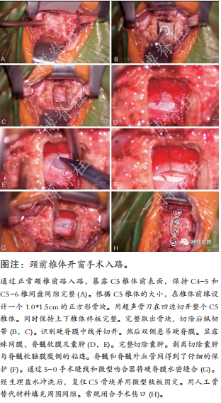 專訪范濤教授 - 唇亡齒寒： 脊髓脊柱外科的前世、今生與未來